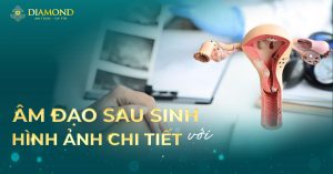 Âm đạo sau sinh với những hình ảnh chi tiết