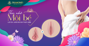 Cắt môi bé