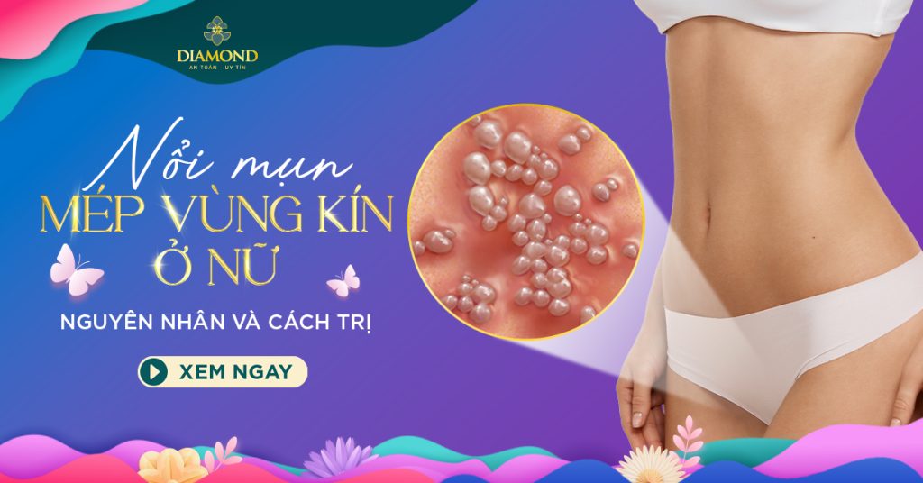 Hình ảnh nổi mụn ở mép vùng kín nữ