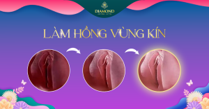 Làm hồng vùng kín