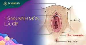 Tầng sinh môn