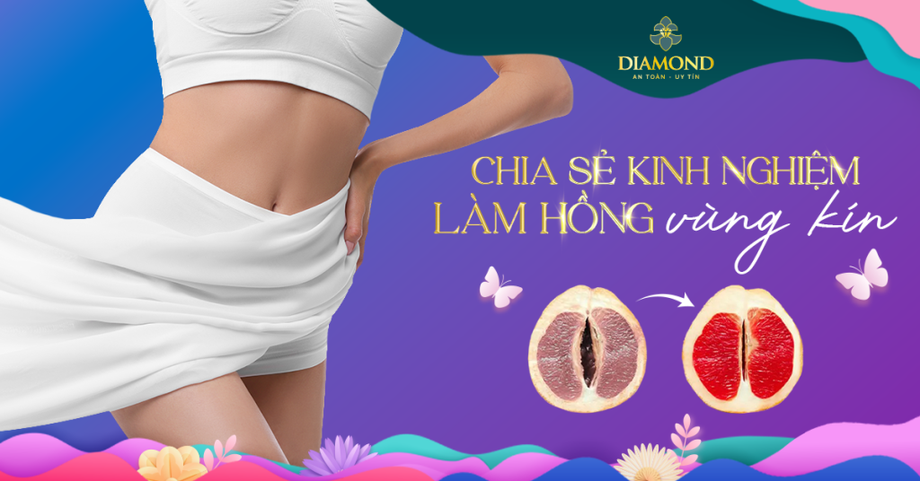 Chia sẻ kinh nghiệm thu hẹp vùng kín